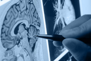 Radiografie cervello